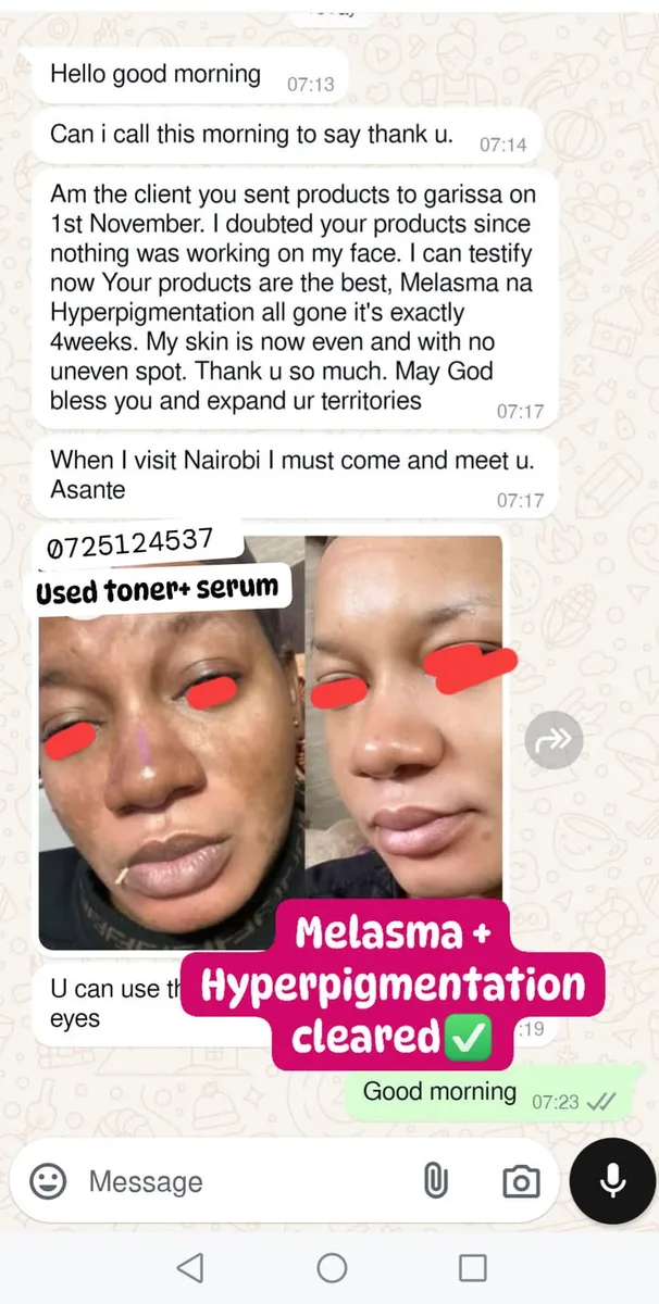 24HR SECRET client before &amp; after result, November 2024