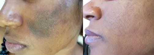 24HR SECRET client before &amp; after result, July 2025