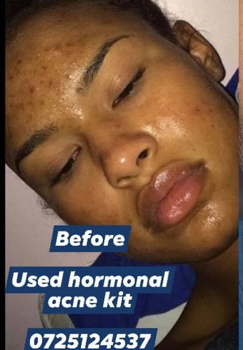 24HR SECRET client before &amp; after result, December 2025