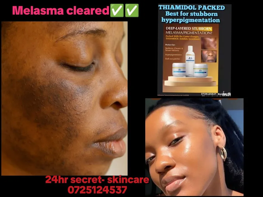 24HR SECRET client before &amp; after result, December 2025