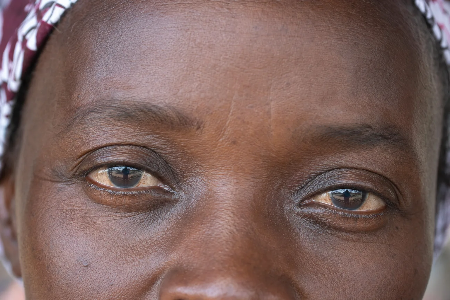 Close-up of fine lines and firm but maturing deep brown skin around the eye of a middle-aged Black African woman
